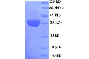 SDS-PAGE (SDS) image for Uncoupling Protein 1 (Mitochondrial, Proton Carrier) (UCP1) (AA 2-307) protein (His tag) (ABIN5713926)