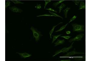 Immunofluorescence (IF) image for anti-Synaptotagmin I (SYT1) (AA 1-422) antibody (ABIN520642)