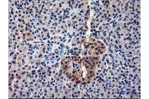 Image no. 11 for anti-NIF3 NGG1 Interacting Factor 3-Like 1 (NIF3L1) antibody (ABIN1496618)