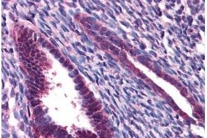 Human Uterus: Formalin-Fixed, Paraffin-Embedded (FFPE) (JMJD1C 抗体  (N-Term))