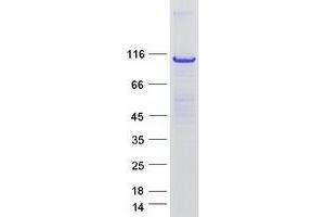 Validation with Western Blot