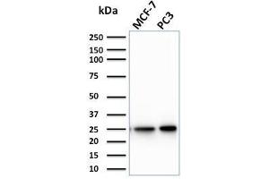 Western Blot Analysis of MCF-7, PC3 cell lysate using CHP2 Mouse Monoclonal Antibody (CPTC-CHP2-1). (Chp2 抗体)