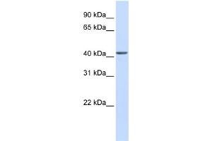 WB Suggested Anti-NOB1 Antibody Titration: 0. (NOB1 抗体  (C-Term))