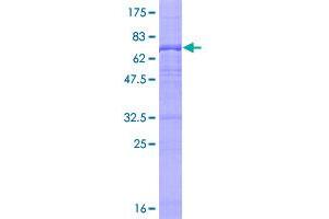 UBE3C Protein (AA 1-404) (GST tag)