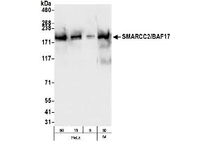 Western Blotting (WB) image for anti-SWI/SNF Related, Matrix Associated, Actin Dependent Regulator of Chromatin, Subfamily C, Member 2 (SMARCC2) (C-Term) antibody (ABIN7454712)