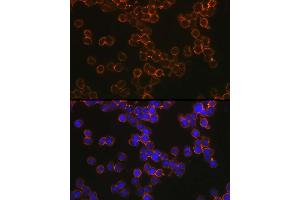 Immunofluorescence analysis of U-937 cells using CD209 Rabbit pAb (ABIN1679076, ABIN5663916, ABIN5663918 and ABIN6218556) at dilution of 1:100 (40x lens). (DC-SIGN/CD209 抗体  (AA 265-404))