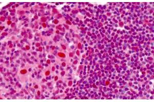Human Tonsil: Formalin-Fixed, Paraffin-Embedded (FFPE) (APEX1 抗体)