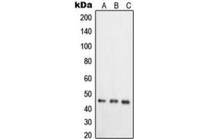 Western blot analysis of RELT expression in HeLa (A), T47D (B), COLO205 (C) whole cell lysates. (RELT 抗体  (C-Term))