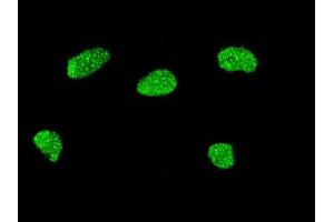 Immunofluorescence of monoclonal antibody to MSX2 on HeLa cell. (Msx2/Hox8 抗体  (AA 101-201))