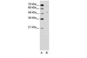Image no. 1 for anti-Zinc Finger Protein 19 (ZNF19) (AA 51-100) antibody (ABIN6736634) (ZNF19 抗体  (AA 51-100))