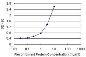 SERPINA3 (Human) Matched Antibody Pair