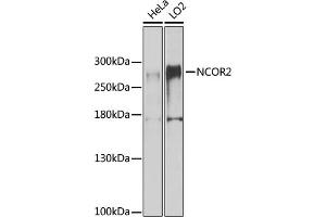 Western blot analysis of extracts of various cell lines, using NCOR2 antibody (ABIN6130575, ABIN6144422, ABIN6144423 and ABIN6224431) at 1:1000 dilution. (NCOR2 抗体  (AA 670-900))