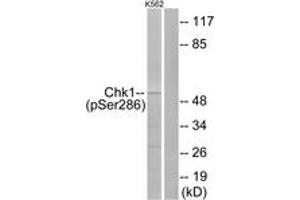 Western blot analysis of extracts from K562 cells treated with Na3VO4 0. (CHEK1 抗体  (pSer286))