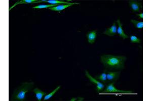 Immunofluorescence of purified MaxPab antibody to USE1 on HeLa cell.