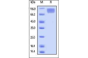 SDS-PAGE (SDS) image for Colony Stimulating Factor 1 Receptor (CSF1R) (AA 20-511) (Active) protein (His tag,AVI tag,Biotin) (ABIN5674611)