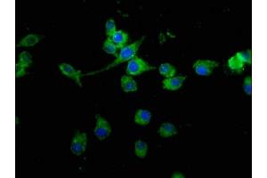 Immunofluorescence staining of SH-SY5Y cells with ABIN7159108 at 1:100, counter-stained with DAPI. (MED15 抗体  (AA 433-530))