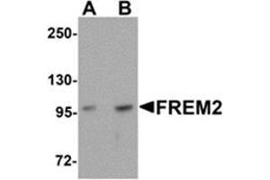 Western blot analysis of FREM2 in A-20 cell lysate with FREM2 antibody at (A) 0. (FREM2 抗体  (Center))