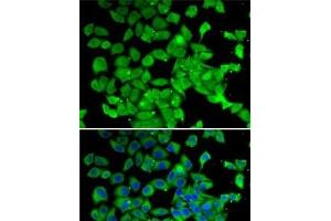 Immunofluorescence analysis of MCF7 cells using PARN Polyclonal Antibody (PARN 抗体)