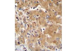 Formalin fixed and paraffin embedded human liver tissue reacted with GGH Antibody (N-term) followed by peroxidase conjugation of the secondary antibody and DAB staining. (GGH 抗体  (N-Term))