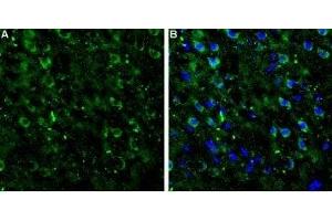 Expression of mGluR7 in rat neocortex - Immunohistochemical staining of rat neocortex frozen sections using Anti-mGluR7 (extracellular) Antibody (ABIN7043255, ABIN7044346 and ABIN7044347). (GRM7 抗体  (Extracellular))