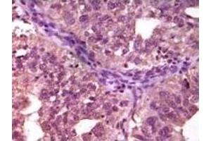 Immunohistochemistry (IHC) image for anti-Ephrin Type A Receptor 1 (EPHA1) (truncated) antibody (ABIN2464049)