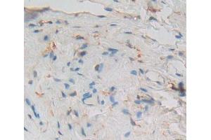 Used in DAB staining on fromalin fixed paraffin- embedded Kidney tissue (PCM1 抗体  (AA 1913-2024))