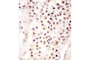 Immunohistochemistry (Paraffin-embedded Sections) (IHC (p)) image for anti-Follistatin-Like 3 (Secreted Glycoprotein) (FSTL3) (AA 229-258), (C-Term) antibody (ABIN656234)