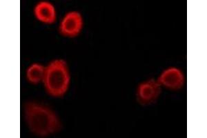 Immunofluorescent analysis of NDUFS4 staining in HepG2 cells. (NDUFS4 抗体)