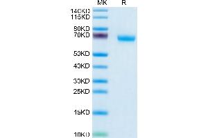 SDS-PAGE (SDS) image for Natural Cytotoxicity Triggering Receptor 1 (NCR1) (AA 22-255) protein (Fc Tag) (ABIN7275351)