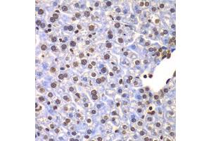 Immunohistochemistry of paraffin-embedded mouse liver using ULK4 antibody (ABIN5975557) at dilution of 1/100 (40x lens). (ULK4 抗体)