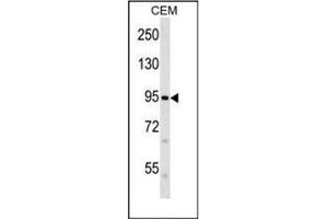 Western blot analysis of FAM38B Antibody (C-term) in CEM cell line lysates (35ug/lane). (PIEZO2 抗体  (C-Term))