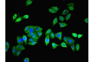 Immunofluorescent analysis of HepG2 cells using ABIN7164219 at dilution of 1:100 and Alexa Fluor 488-congugated AffiniPure Goat Anti-Rabbit IgG(H+L) (PFDN5 抗体  (AA 2-154))