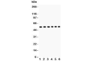 Western blot testing of CD8 antibody and Lane 1:  Jurkat;  2: Raji;  3: HL-60;  4: A549;  5: COLO320;  6: HeLa lysate;  Predicted size: 34KD;  Observed size: 34~60KD depending on glycosylation level (CD8 抗体  (AA 22-187))