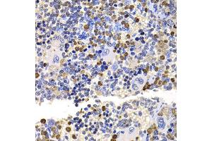 Immunohistochemistry of paraffin-embedded rat spleen using UBE2V2 antibody (ABIN5975744) at dilution of 1/100 (40x lens). (UBE2V2 抗体)