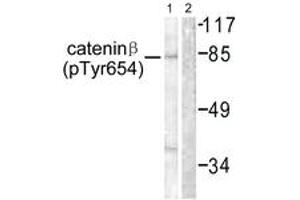 Western blot analysis of extracts from 293 cells, using Catenin-beta (Phospho-Tyr654) Antibody. (beta Catenin 抗体  (pTyr654))