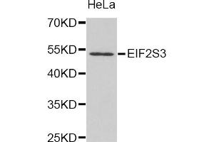 Western blot analysis of extracts of HeLa cell line, using EIF2S3 antibody. (EIF2S3 抗体)