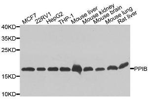 Western blot analysis of extracts of various cell lines, using PPIB antibody. (PPIB 抗体  (AA 34-216))