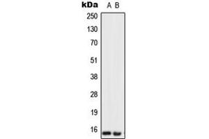 Western blot analysis of Urotensin 2 expression in SKBR3 (A), U251MG (B) whole cell lysates. (Urotensin 2 抗体  (Center))
