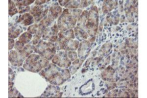 Image no. 4 for anti-RIO Kinase 2 (RIOK2) (AA 277-552) antibody (ABIN1491304)