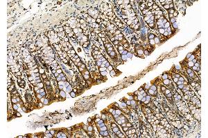 ABIN6264315 and ABIN6276587 at 1/100 staining Rat stomach tissue by IHC-P.