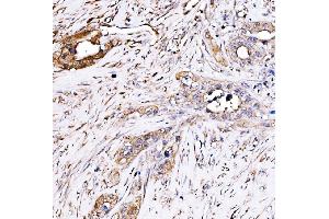 IHC analysis of PAK2 using anti-PAK2 antibody (ABIN7599219). (PAK2 抗体  (AA 1-288))