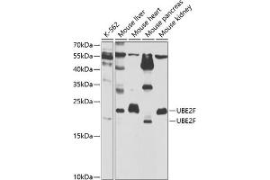 Western blot analysis of extracts of various cell lines, using UBE2F antibody  at 1:1000 dilution. (UBE2F 抗体  (AA 1-185))