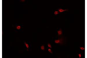 ABIN6269260 staining HeLa? (JNK 抗体)