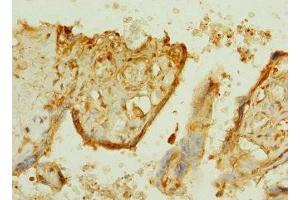 Immunohistochemistry of paraffin-embedded human placenta tissue using ABIN7164617 at dilution of 1:100 (TTLL2 抗体  (AA 401-592))