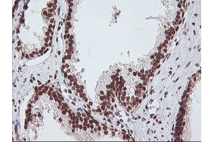 Image no. 13 for anti-Exosome Component 7 (EXOSC7) antibody (ABIN1498140)