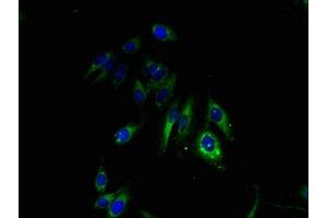 Immunofluorescent analysis of Hela cells using ABIN7153613 at dilution of 1:100 and Alexa Fluor 488-congugated AffiniPure Goat Anti-Rabbit IgG(H+L) (Connexin 31 抗体  (AA 211-270))