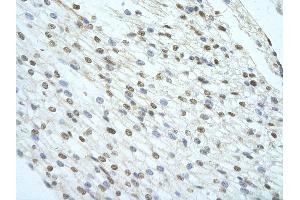 Immunohistochemistry (IHC) image for anti-KH-Type Splicing Regulatory Protein (KHSRP) (Middle Region) antibody (ABIN2778858)