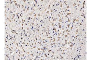 IHC analysis of RPL11 using anti-RPL11 antibody (ABIN7602315). (RPL11 抗体  (AA 7-178))