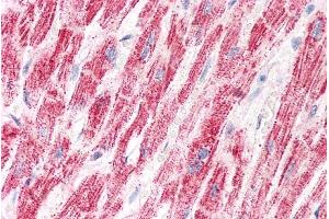 ABIN571194 (5µg/ml) staining of paraffin embedded Human Heart. (ETFA 抗体  (AA 139-152))