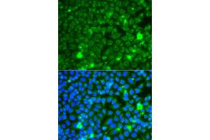 Immunofluorescence analysis of A549 cells using GBA3 antibody.